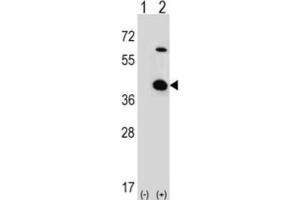 Western Blotting (WB) image for anti-Serine/threonine Kinase Receptor Associated Protein (STRAP) antibody (ABIN3001728) (STRAP Antikörper)