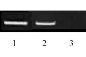 Histone H3 dimethyl Lys9 antibody tested by ChIP.