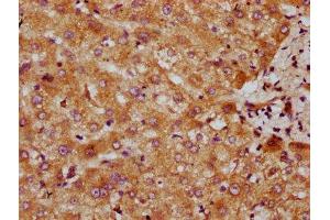 IHC image of ABIN7147604 diluted at 1:300 and staining in paraffin-embedded human liver tissue performed on a Leica BondTM system. (CYP7A1 Antikörper  (AA 303-423))