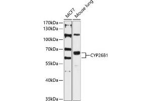 Western blot analysis of extracts of various cell lines, using CYP26B1 antibody (ABIN6130158, ABIN6139325, ABIN6139326 and ABIN6215727) at 1:3000 dilution. (CYP26B1 Antikörper  (AA 213-512))