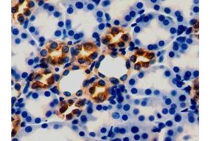 DAB staining on IHC-P; Samples: Rat Kidney Tissue (Peroxiredoxin 5 Antikörper  (AA 1-213))