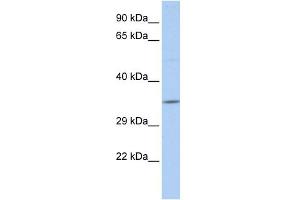 WB Suggested Anti-SCAND2 Antibody Titration:  0. (SCAND2 Antikörper  (N-Term))