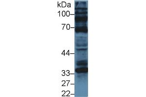 Western Blot; Sample: Human U87MG cell lysate; Primary Ab: 5µg/ml Rabbit Anti-Bovine CCND1 Antibody Second Ab: 0. (Cyclin D1 Antikörper  (AA 72-272))