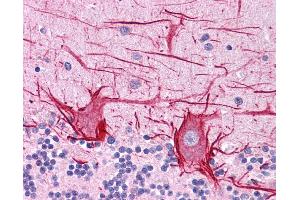 ApoB antibody was used for immunohistochemistry at a concentration of 4-8 ug/ml. (APOB Antikörper  (Middle Region))