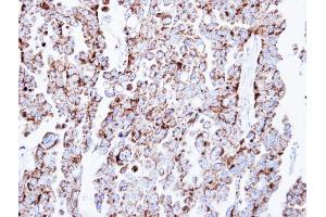Immunohistochemistry (IHC) image for anti-Prohibitin (PHB) antibody (ABIN2854938)