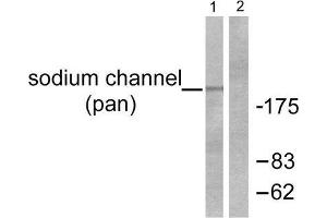 Western Blotting (WB) image for anti-Sodium Channel (Internal Region), (pan) antibody (ABIN1848776) (Sodium Channel Antikörper  (Internal Region, pan))