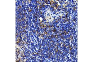 Immunohistochemistry of paraffin-embedded rat spleen using NF-kB p65/RelA antibody (ABIN7268995) at dilution of 1:100 (40x lens). (NF-kB p65 Antikörper)