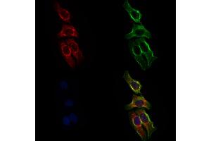 ABIN6258793 and ABIN6275993 staining Hela cells by IF/ICC. (FZD8 Antikörper  (N-Term))