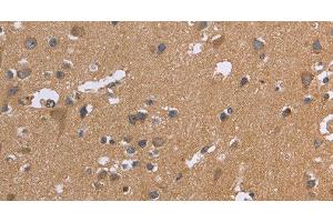 Immunohistochemistry of paraffin-embedded Human brain tissue using KIAA1324 Polyclonal Antibody at dilution 1:30 (ELAPOR1 Antikörper)