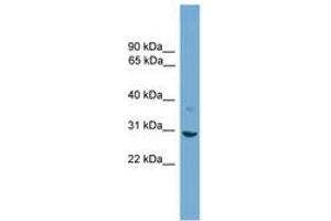 Image no. 1 for anti-Stratifin (SFN) (AA 51-100) antibody (ABIN6745577) (14-3-3 sigma/SFN Antikörper  (AA 51-100))