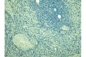 Immunohistochemistry (IHC) image for anti-Ionized Calcium-binding Adapter Molecule 1 (IBA1) (C-Term) antibody (ABIN184738)