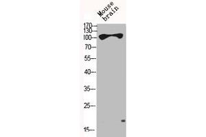 Western Blot analysis of MOUSE-BRAIN cells using HXK I Polyclonal Antibody (Hexokinase 1 Antikörper  (N-Term))