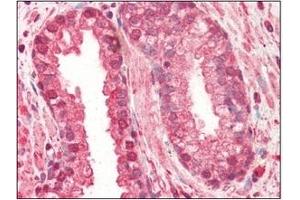 Immunohistochemistry (IHC) image for anti-Cathepsin L1 (CTSL1) (AA 114-333) antibody (ABIN317508) (Cathepsin L Antikörper  (AA 114-333))