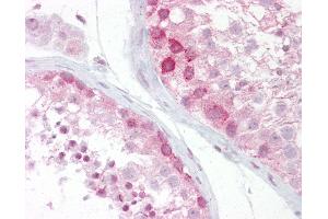 Immunohistochemistry (IHC) image for anti-Wingless-Type MMTV Integration Site Family, Member 2B (WNT2B) (N-Term) antibody (ABIN6748587)