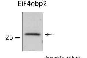 Sample Type: HEK 293 cells (50ug)Primary Dilution: 1:1000Image Submitted by: Veronique DorvalLaval University, Canada . (eIF4EBP2 Antikörper  (N-Term))