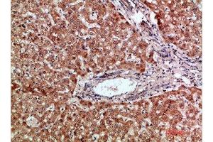 Immunohistochemical analysis of paraffin-embedded human-liver, antibody was diluted at 1:200 (CCL2 Antikörper  (AA 31-80))