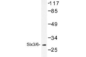 Image no. 1 for anti-Sine Oculis-Related Homeobox 3 (SIX3) antibody (ABIN272150) (SIX3 Antikörper)
