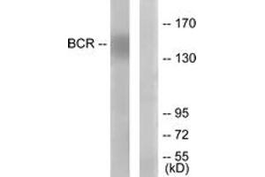 Western blot analysis of extracts from K562 cells, using Bcr (Ab-177) Antibody. (BCR Antikörper  (AA 144-193))