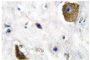 Image no. 1 for anti-Glutamate Decarboxylase 1 (Brain, 67kDa) (GAD1) antibody (ABIN265428) (GAD Antikörper)