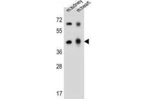 Western Blotting (WB) image for anti-Adenosine Deaminase-Like Protein (ADAL) antibody (ABIN2997438) (ADAL Antikörper)