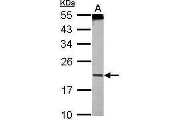 PDCD6 Antikörper