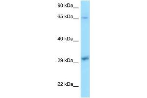 WB Suggested Anti-XPA Antibody Titration: 1. (XPA Antikörper  (C-Term))