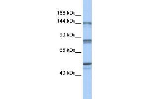 WB Suggested Anti-CSE1L Antibody Titration:  0.