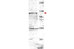 Western blot using NEDD4 polyclonal antibody  shows detection of a 115 kDa band corresponding to endogenous NEDD4 (arrowhead) in MDA-MB-435 cell lysates. (NEDD4 Antikörper  (Internal Region))