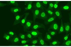 Immunofluorescence analysis of A549 cells using RFC1 Polyclonal Antibody (RFC1 Antikörper)