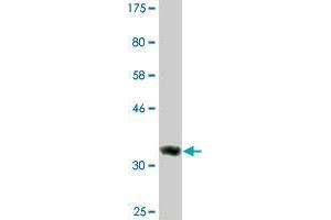 Western Blot detection against Immunogen (36. (DICER1 Antikörper  (AA 1813-1912))