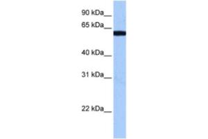 Western Blotting (WB) image for anti-RNA Binding Motif Protein 14 (RBM14) antibody (ABIN2462204) (RBM14 Antikörper)