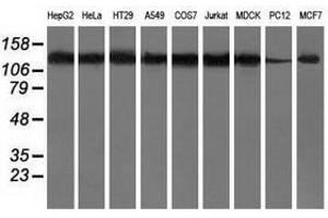 Image no. 2 for anti-Histone Deacetylase 6 (HDAC6) antibody (ABIN1498620) (HDAC6 Antikörper)
