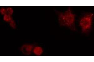 ABIN6272434 staining HuvEc by IF/ICC. (Splicing Factor 1 Antikörper  (N-Term))