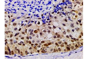 Immunohistochemistry (IHC) image for anti-LIM Domain Kinase 1 (LIMK1) (pThr508) antibody (ABIN6255701)