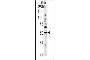 The anti-G4C Pab 1810b is used in Western blot to detect G4C in Hela tissue lysate (ATG4C Antikörper  (AA 167-196))