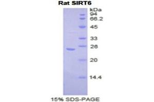 SDS-PAGE (SDS) image for Sirtuin 6 (SIRT6) (AA 88-288) protein (His tag) (ABIN2122098)