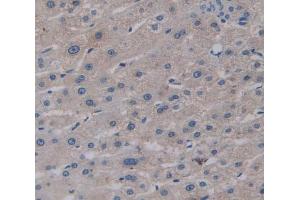 Used in DAB staining on fromalin fixed paraffin- embedded Kidney tissue (GGPS1 Antikörper  (AA 1-290))