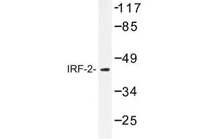 Image no. 1 for anti-Interferon Regulatory Factor 2 (IRF2) antibody (ABIN272167) (IRF2 Antikörper)