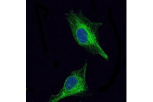 Immunocytochemistry (ICC) image for anti-Oligodendrocyte Lineage Transcription Factor 2 (OLIG2) antibody (ABIN1845900)