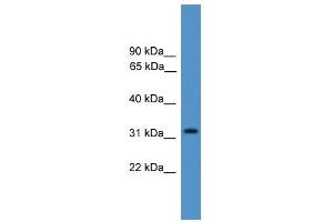 Western Blotting (WB) image for anti-Proteasome (Prosome, Macropain) Inhibitor Subunit 1 (PI31) (PSMF1) (Middle Region) antibody (ABIN2787963)