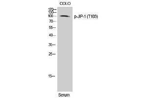 Western Blotting (WB) image for anti-Mitogen-Activated Protein Kinase 8 Interacting Protein 1 (MAPK8IP1) (pThr103) antibody (ABIN3182443) (MAPK8IP1 Antikörper  (pThr103))
