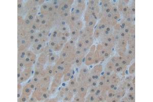 Used in DAB staining on fromalin fixed paraffin- embedded liver tissue (DKC1 Antikörper  (AA 298-465))