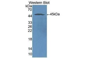 Detection of Recombinant ICAM1, Human using Monoclonal Antibody to Intercellular Adhesion Molecule 1 (ICAM1) (ICAM1 Antikörper  (AA 41-464))