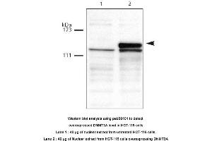 Image no. 1 for anti-Deoxyribonucleic Acid (DNA) (AA 10-118) antibody (ABIN363410) (DNA Antikörper  (AA 10-118))