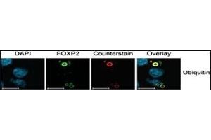 Characterization of FOXP2 Isoforms. (Ubiquitin Antikörper  (AA 36-66))