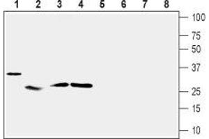 Western blot analysis of mouse heart (lanes 1 and 5), rat skeletal muscle (lanes 2 and 6), rat adipose tissue (lanes 3 and 7) and rat pancreas (lanes 4 and 8): - 1-4. (UCP2 Antikörper  (Intracellular))
