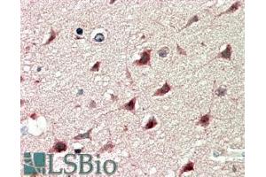 ABIN185538 (5µg/ml) staining of paraffin embedded Human Cerebral Cortex. (DCDC2 Antikörper  (Internal Region))