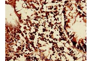 Immunohistochemistry of paraffin-embedded human appendix tissue using ABIN7158291 at dilution of 1:100 (LAIR1 Antikörper  (AA 22-165))