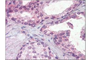 Human Prostate (formalin-fixed, paraffin-embedded) stained with IFNAR2followed by biotinylated anti-goat IgG secondary antibody, alkaline phosphatase-streptavidin and chromogen. (IFNAR2 Antikörper  (Internal Region))