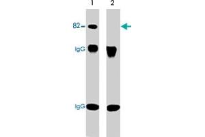 Western blot analysis of immunoprecipitates from neonatal rat brain lysate using anti-PRKCA antibody. (PKC alpha Antikörper  (pSer657, pTyr658))